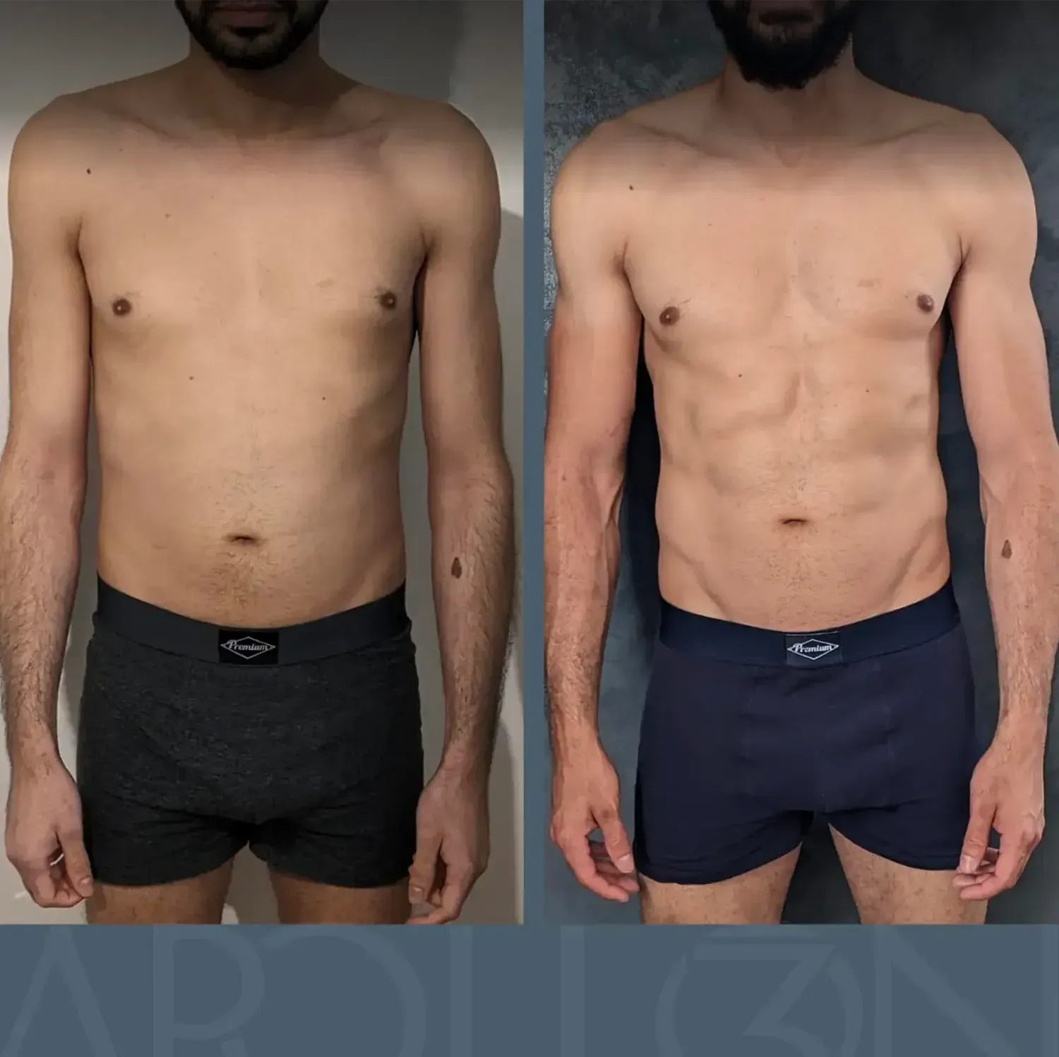Transformation de Ahmed