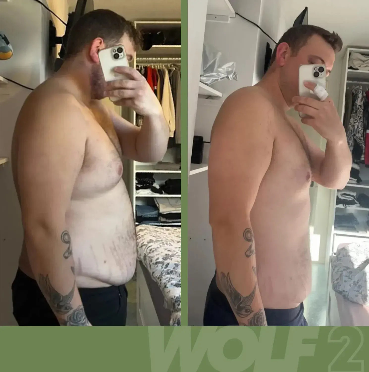 Transformation de Anthony