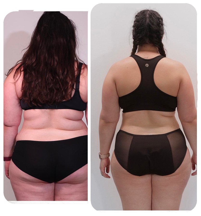 Transformation